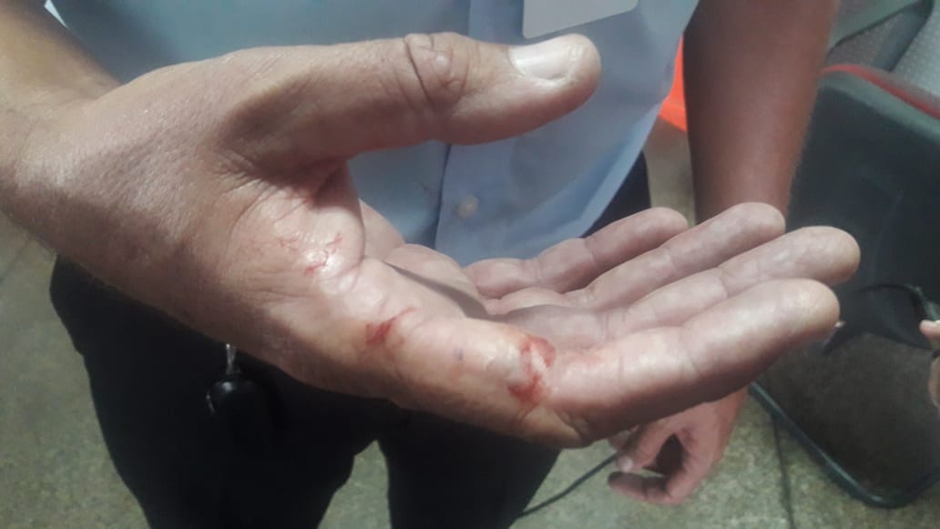 Taxista fica ferido ao tentar impedir que carro seja levado por assaltante em Manaus