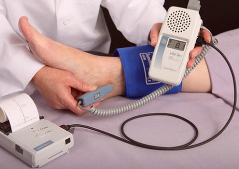 Exame de Índice Tornozelo-Braquial é um aliado dos pacientes cardiovasculares. Saiba mais