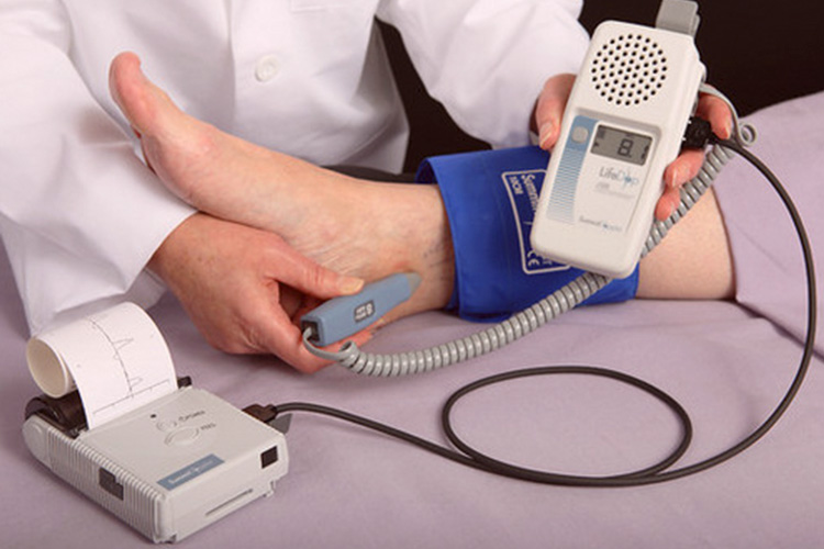 Exame de Índice Tornozelo-Braquial é um aliado dos pacientes cardiovasculares. Saiba mais