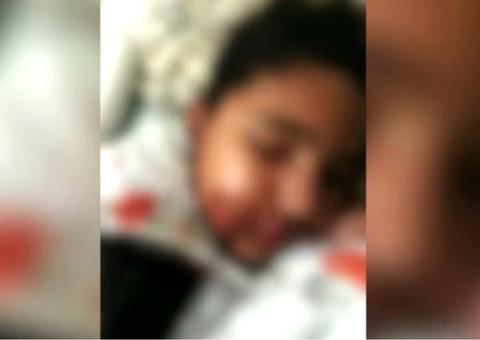 Menina tem rosto queimado pela mãe por não fazer tarefa de casa