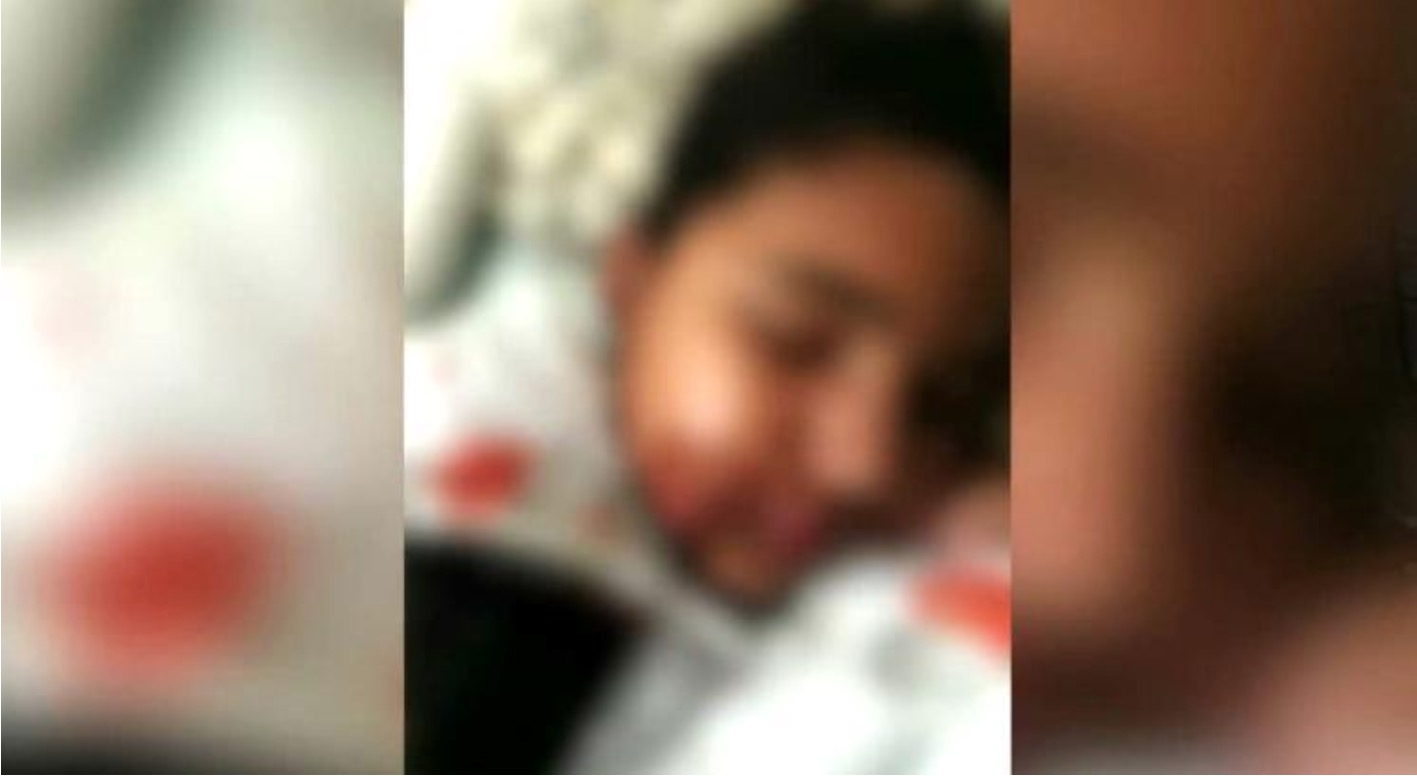 Menina tem rosto queimado pela mãe por não fazer tarefa de casa