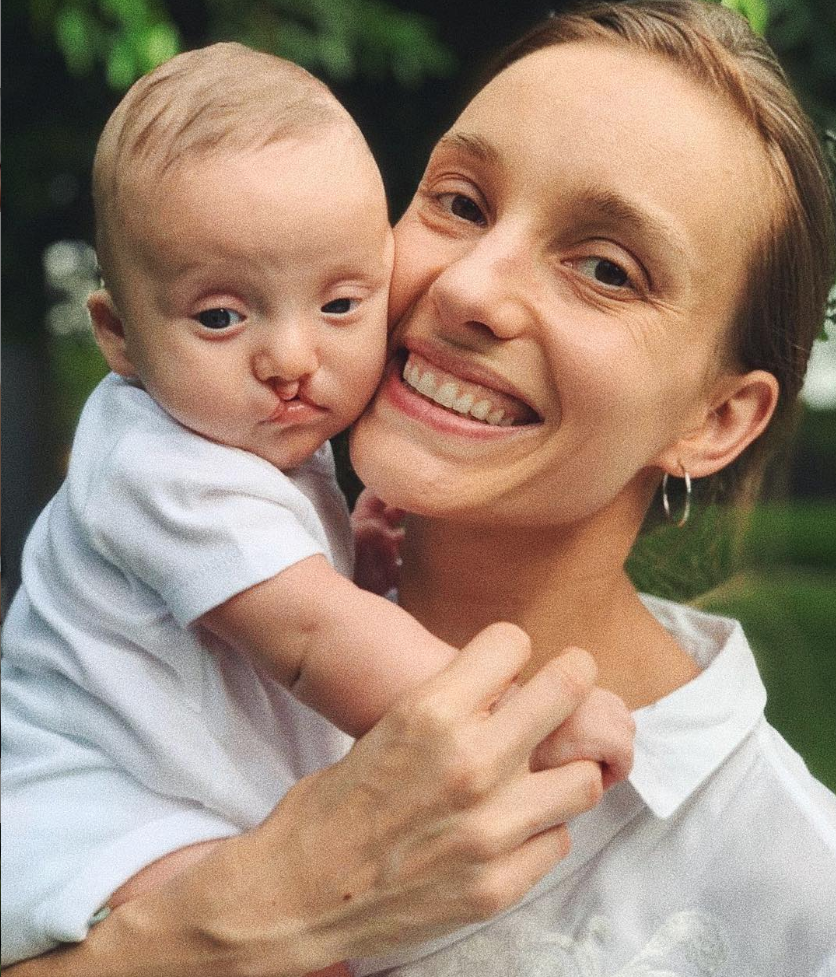 Irmã de Ana Hickmann rebate seguidor que chamou seu filho de ‘defeituoso'