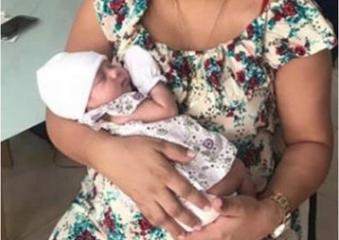 Bebê nasce com feto dentro do abdômen em caso raro de gravidez