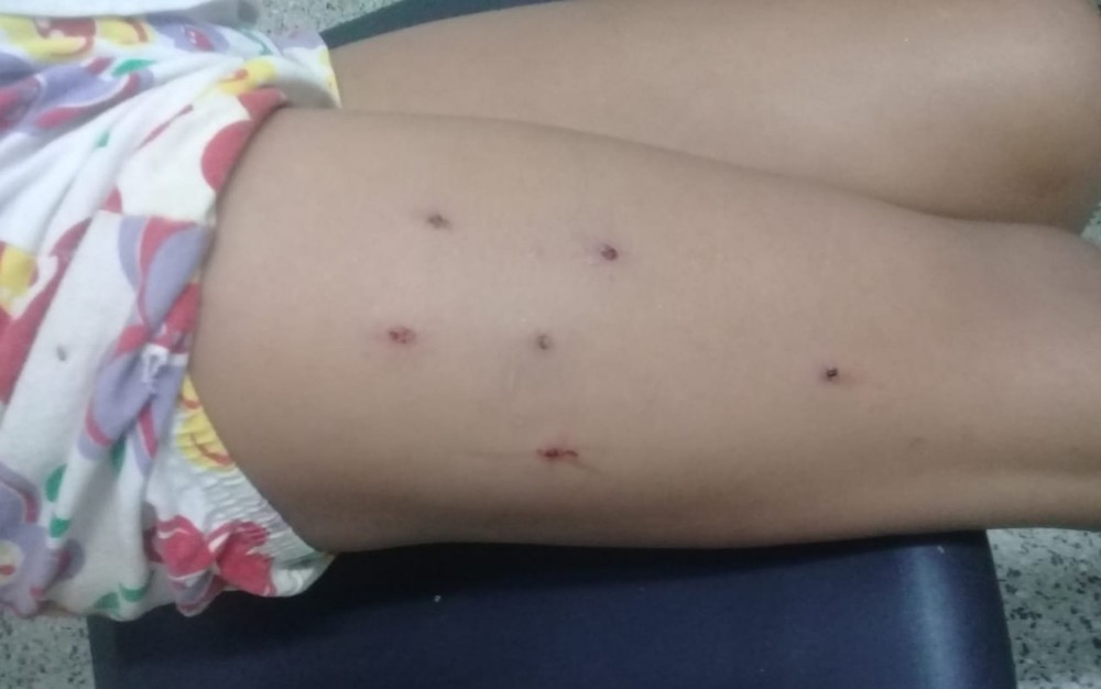 Corretor é suspeito de atirar em criança com fuzil de airsoft