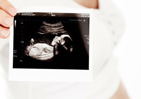 Médico encontra feto dentro de bebê durante exame de ultrassom