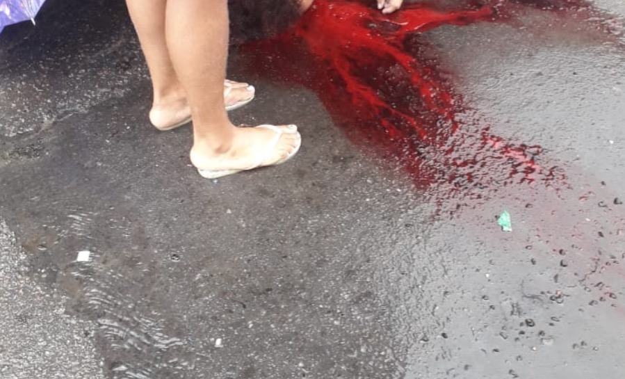 Em Manaus, mulher despenca de laje durante chuva e fica gravemente ferida 