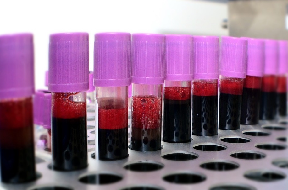 Com estoque crítico, Hemoam convoca doadores voluntários de sangue