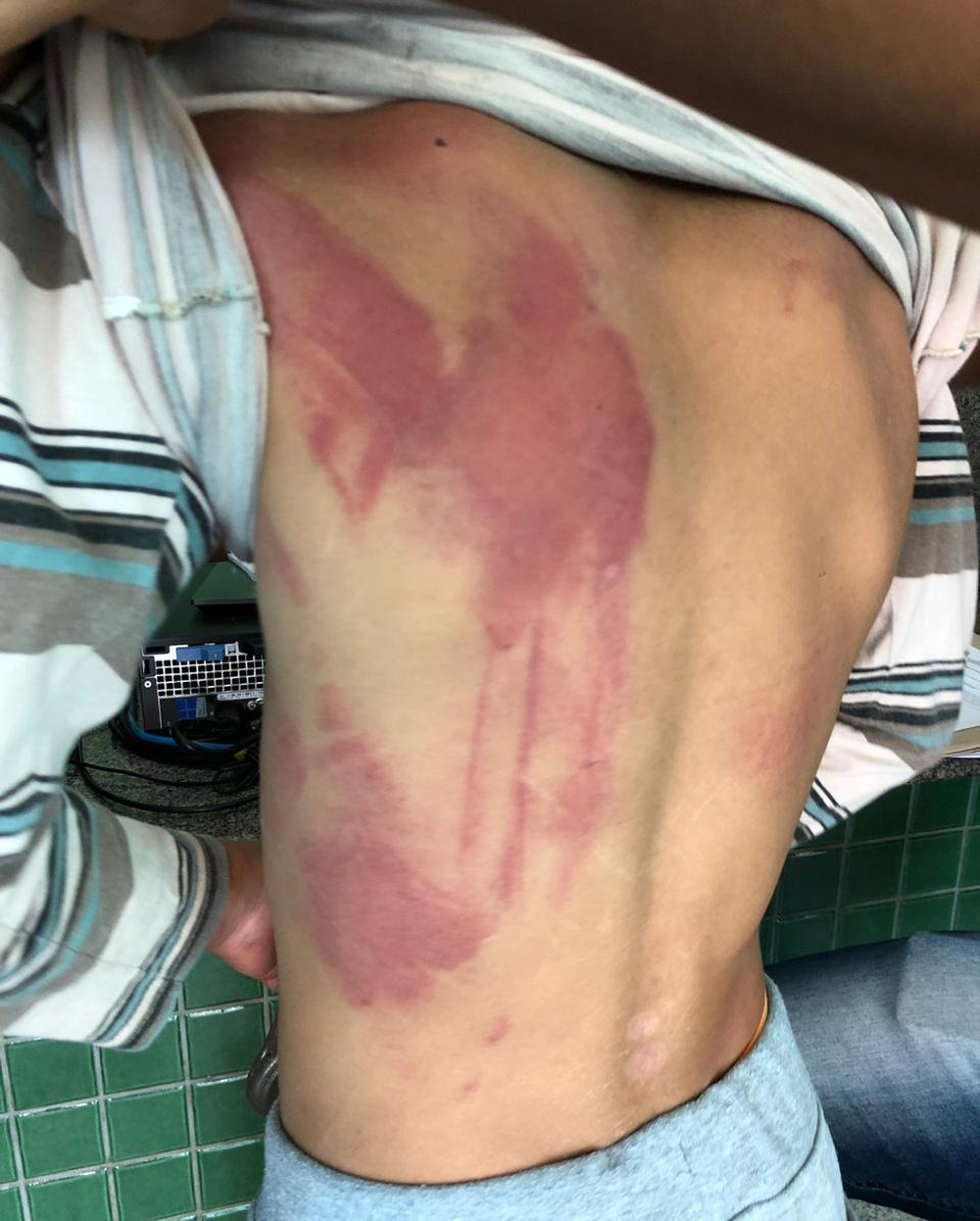 Mulher é presa por espancar e acorrentar filho de 9 anos