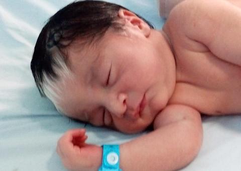 Bebê nasce com mecha branca no cabelo e encanta internautas 