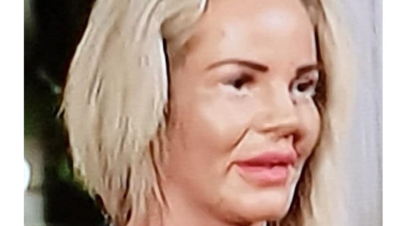 Mãe incentiva filha ter relações sexuais com homens para pagar suas cirurgias plásticas