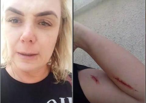 Ex-paquita denuncia suposta agressão do marido e ele rebate: ‘descontrole emocional’