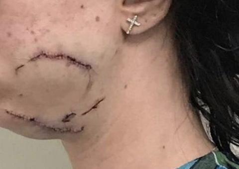 Assessor do PT é suspeito de agredir mulher a garrafadas durante orgia em motel