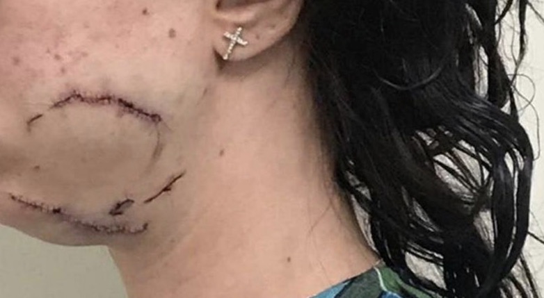 Assessor do PT é suspeito de agredir mulher a garrafadas durante orgia em motel