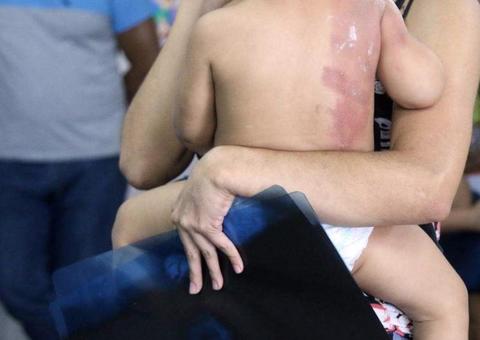Após acidente doméstico, menino de 4 anos é espancado pelo padrasto em Manaus