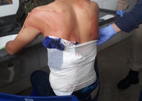 Médica é afastada após liberar jovem com perfuração no pulmão