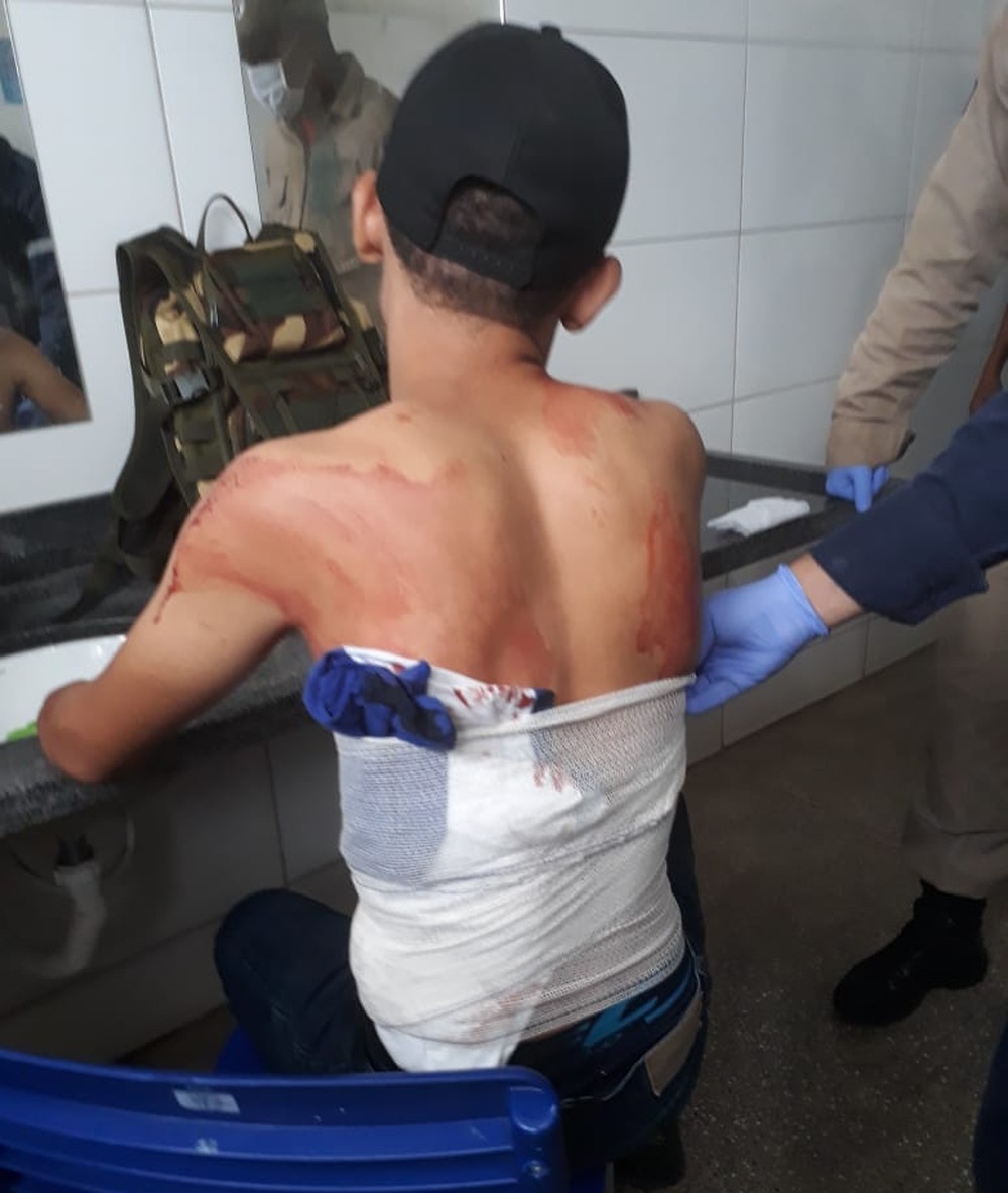 Médica é afastada após liberar jovem com perfuração no pulmão