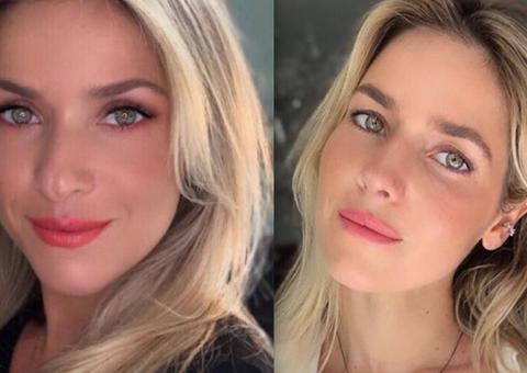 Monique Alfradique mostra resultado de cirurgia no nariz