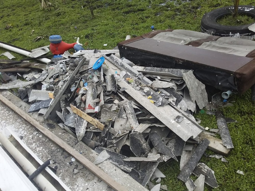 Bebê tem braço amputado após ser atingido por telha de sua casa 