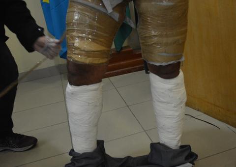 Homem é preso no aeroporto com drogas escondidas nas pernas 