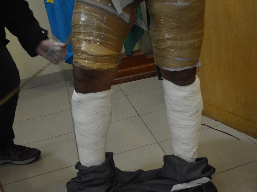 Homem é preso no aeroporto com drogas escondidas nas pernas 