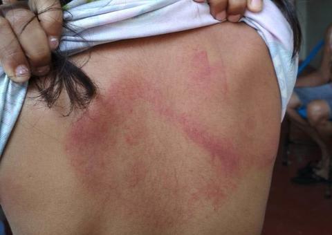 Em Manaus, mãe é detida após espancar a filha de 5 anos que se recusou tomar banho