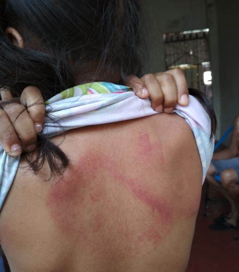 Em Manaus, mãe é detida após espancar a filha de 5 anos que se recusou tomar banho