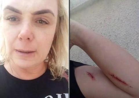 Vídeo mostra ex-paquita se machucando antes de acusar marido de agressão