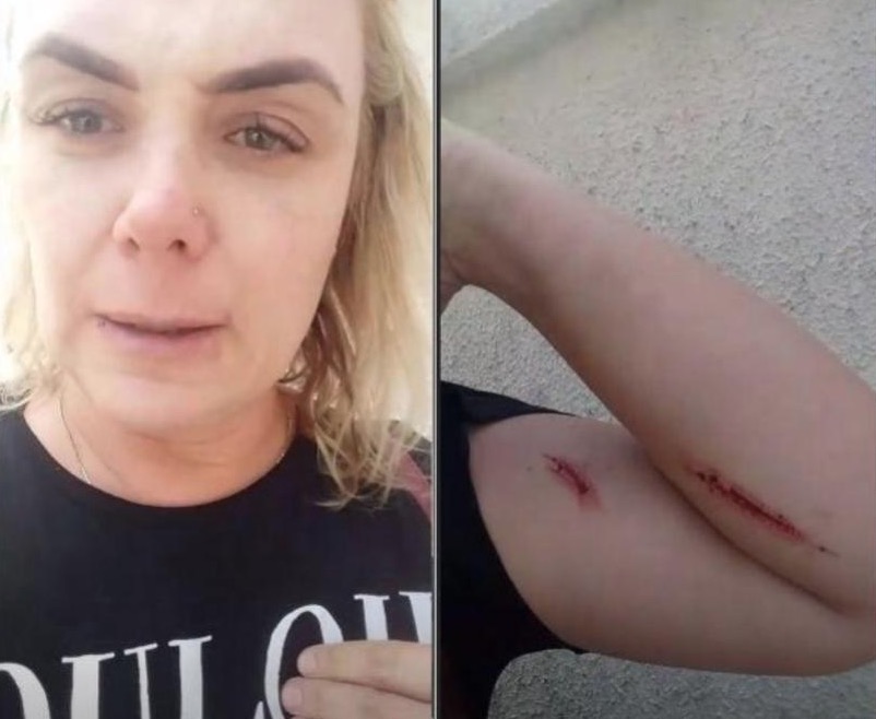 Vídeo mostra ex-paquita se machucando antes de acusar marido de agressão