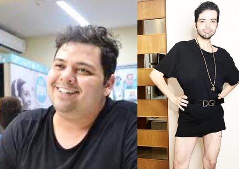 Gustavo Mendes mostra 'antes e depois' de perder 48 kg por cirurgia bariátrica
