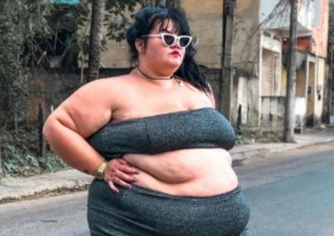  Após acidente, bailarina plus size volta a desabafar sobre falta de acessibilidade