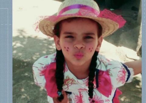 Morre menina que teve 80% do corpo queimado em vazamento de gasolina no RJ 