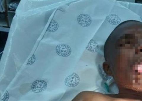 Mulher arranca parte da língua de homem que a beijou à força