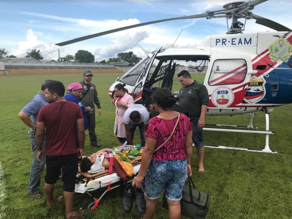 Criança de 8 anos é resgatada por helicóptero da SSP após grave acidente no Amazonas