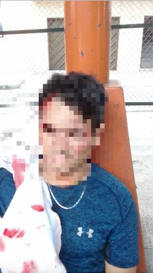 Homem é atropelado por ônibus dentro do T1 em Manaus 