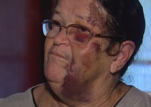 Motorista que arrastou vendedora de balões disse ter feito “brincadeira”