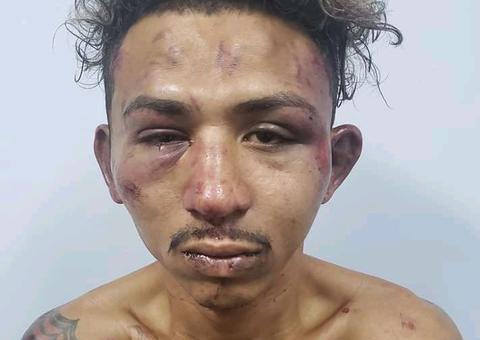 Suspeito de assaltar mercadinho e atirar no proprietário é espancado por populares em Manaus 