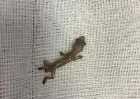 Médica acha lagartixa viva vivendo dentro de ouvido de paciente