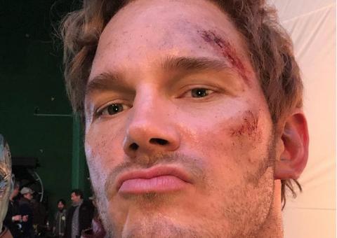 Chris Pratt surpreende ao postar foto completamente nu