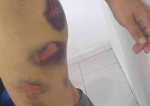 Jovem é preso por agredir e fazer ex-namorada comer fezes de animais 