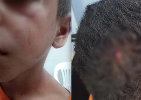 Mulher é presa suspeita de agredir e esfaquear a cabeça do próprio filho em Manaus