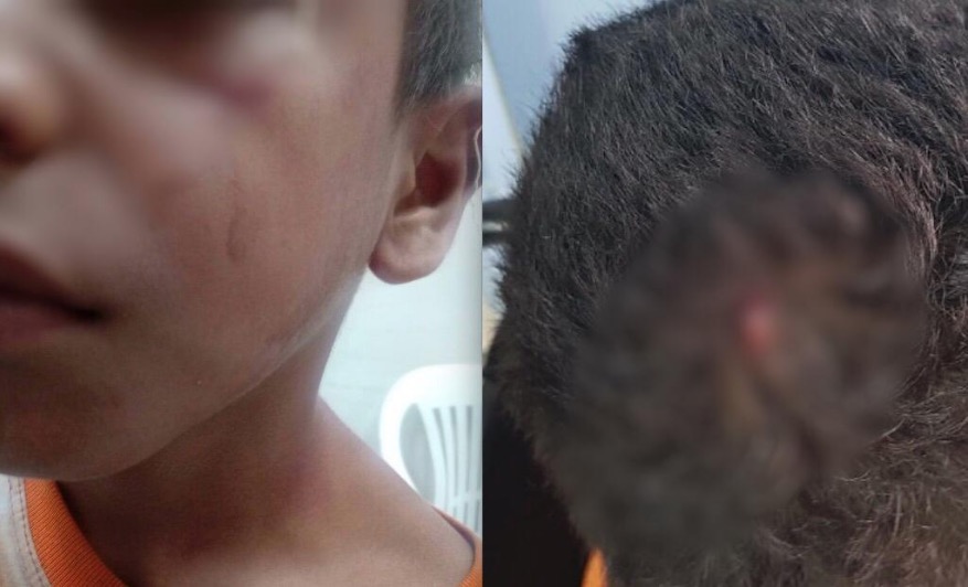 Mulher é presa suspeita de agredir e esfaquear a cabeça do próprio filho em Manaus