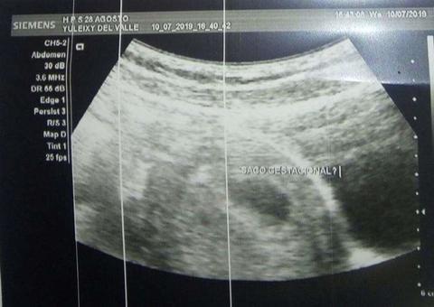 Venezuelana que acusa padre de estupro em Manaus está grávida