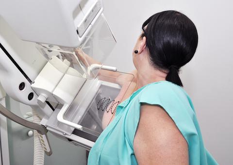 Mulheres acima de 40 anos têm garantido exame de mamografia pelo SUS