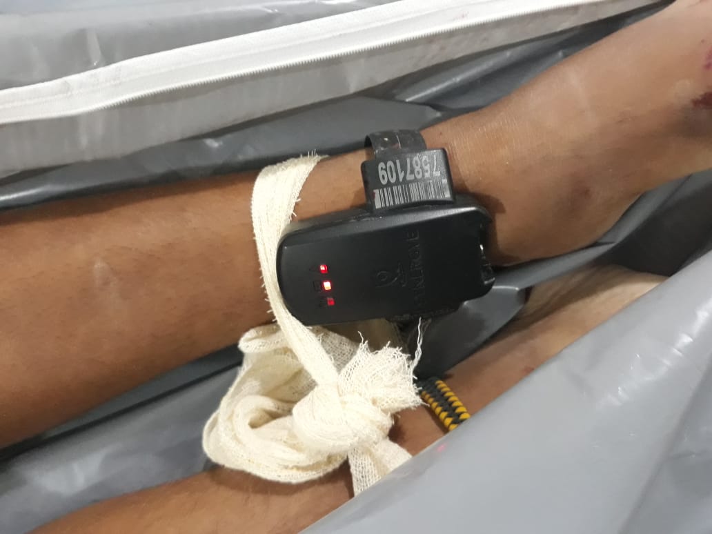 Cadeirante e homem são assassinados a tiros em Manaus 