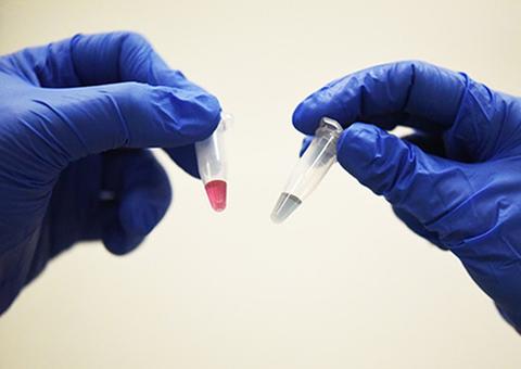 Número de mortes associadas a Aids caem 33% em quase dez anos