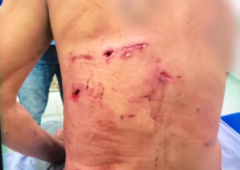  Homem atacado por onça é salvo por 5 cachorros em fazenda