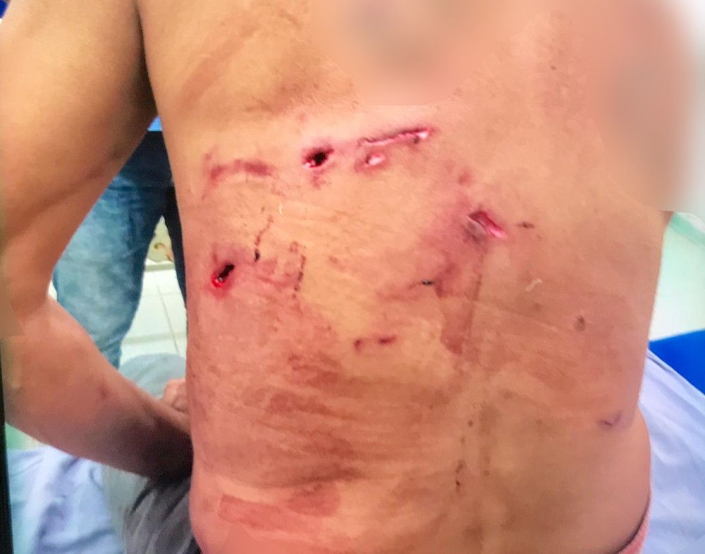  Homem atacado por onça é salvo por 5 cachorros em fazenda