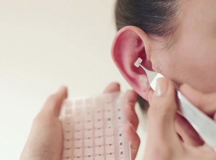 Curso de Auriculoterapia tem inscrições abertas para Manaus