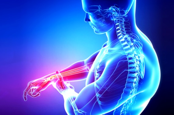 Julho Amarelo: Saiba como identificar os sintomas do câncer ósseo