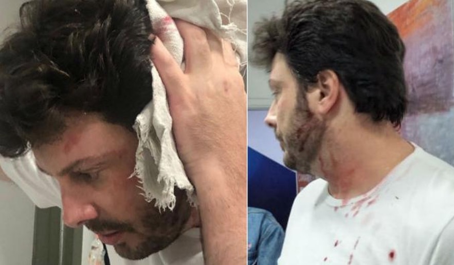 Vídeo: Danilo Gentili leva garrafada durante gravação 